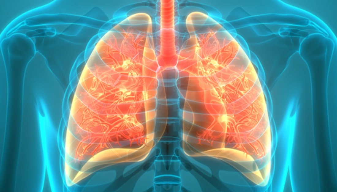 Tuberculosis (TB) | Washington County, OR Tuberculosis (TB) | Washington County, OR